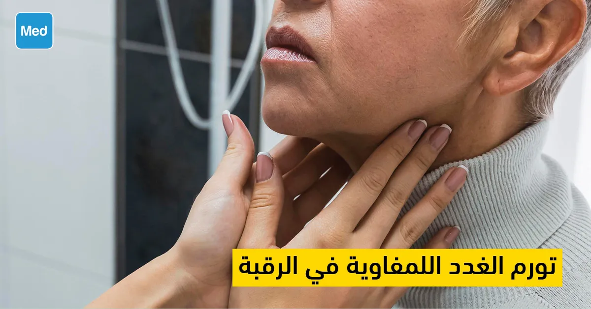 تورم الغدد اللمفاوية في الرقبة